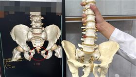 沙袋重砸男失血1/3且骨盆爆　醫4小時搶命（圖／翻攝畫面）