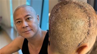 草蜢蔡一傑傳癌細胞擴散暴瘦　本人發聲了
