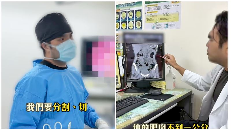 醫懲會決議廢止執業執照，被迫脫下醫師袍，相關案情移送地檢署偵辦。（圖／翻攝自王銘嶼IG）