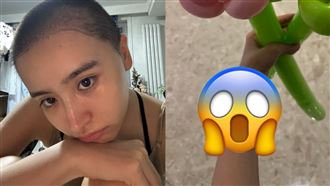 26歲女星才暴瘦剃光頭　手腕多條疤疑自殘