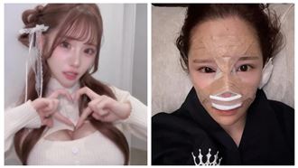 母譙：不該生下你！網紅燒530萬驚悚開刀