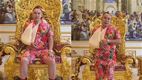 胡漢龑玩遊戲意外撞傷，導致骨頭裂掉，手肘打石膏勇用綁帶固定，雙膝及手腕都破皮。（圖／翻攝自胡漢龑IG）