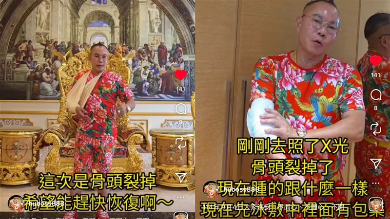 胡漢龑去照X光,顯示骨頭裂掉,「現在腫的跟甚麼一樣,只能用冰敷袋,裡面是藥膏。」(圖/翻攝自胡漢龑IG)