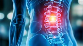 上班族,腰酸背痛,背痛。（示意圖／PIXABAY）