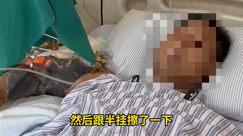 經醫療團隊4小時搶救，最終成功接回並恢復血流。(圖／翻攝自微博)