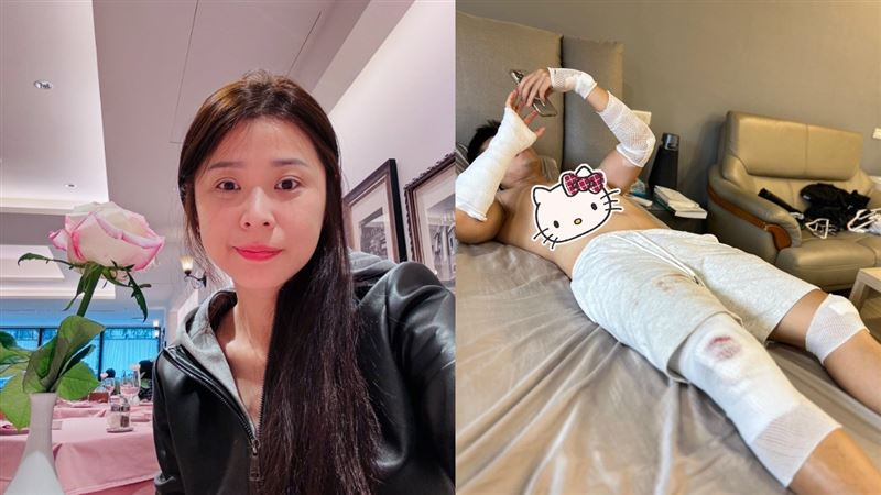 李燕崩潰表示家人摔傷，讓她擔心爆哭。（圖／翻攝自臉書）