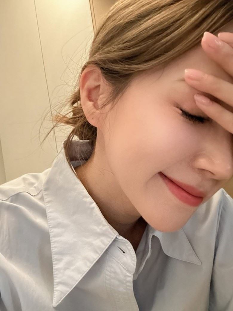 傅嘉莉日前傳出自己不慎遭割傷眼角膜。(圖/翻攝自IG @kelly.fuu)