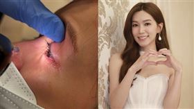 傅嘉莉日前傳出自己不慎遭割傷眼角膜。（圖／翻攝自IG @kelly.fuu）