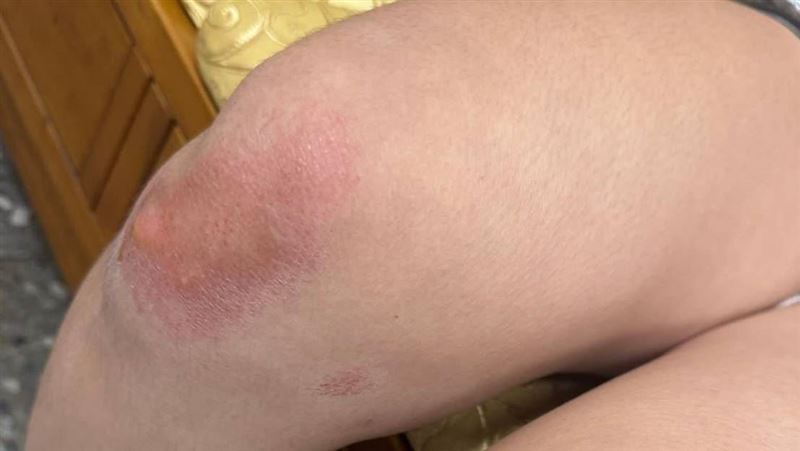 2少女看電影被打到腦震盪　父決定要告了