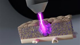 德國科學家開發抗癌新武器！「冷電漿」光束可摧毀隱藏腫瘤細胞(圖／翻攝自SciTechDaily網站)