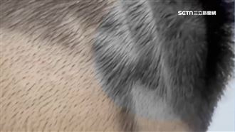 兒剃閃電頭皮滲血痕　理髮師稱「正常」