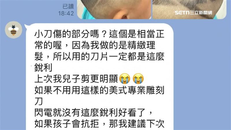 理髮師稱說「是正常現象」