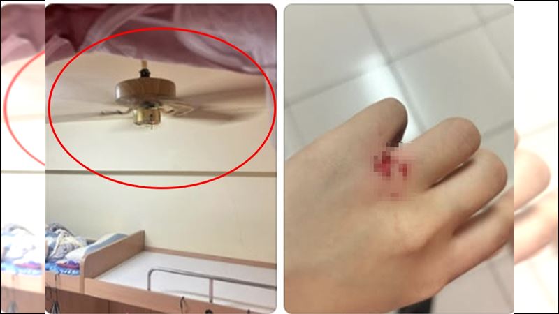 長榮大學女學生被宿舍吊扇削掉一層皮滲血。（圖／翻攝自記者爆料網）