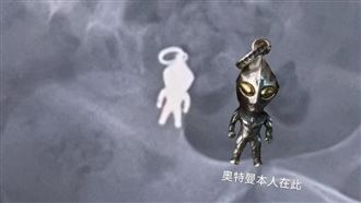 8歲童誤吞「超人力霸王」醫:器官恐穿孔