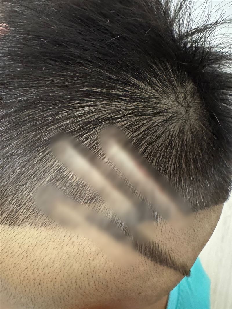 5歲男童理髮時頭皮被割6道刀痕，事後還發炎掛急診治療。（圖／翻攝自臉書）