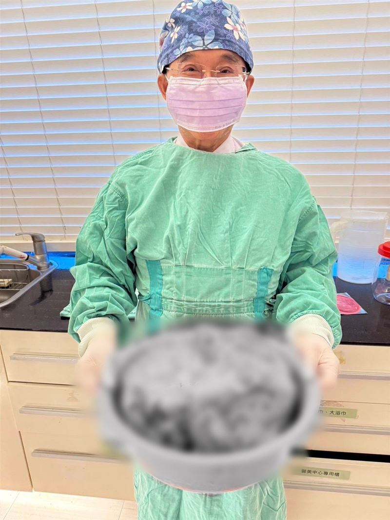 洗臉盆裝竟然裝得下！新北一位林太太肚子大如懷胎10月，一檢查赫然竟是比西瓜大卵巢巨瘤。（圖／愛麗生婦產科診所提供）