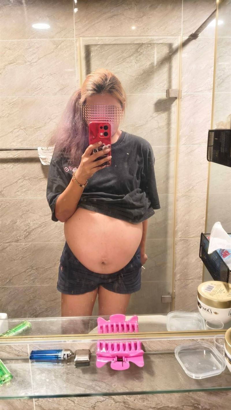 洗臉盆裝竟然裝得下！新北一位林太太肚子大如懷胎10月，一檢查赫然竟是比西瓜大卵巢巨瘤。（圖／愛麗生婦產科診所提供）