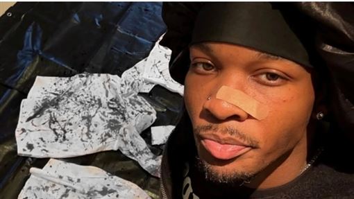 車箱藏肢解腐屍！10億歌手正式被視為疑兇