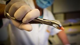 鉗子、拔牙（示意圖／PIXABAY）
