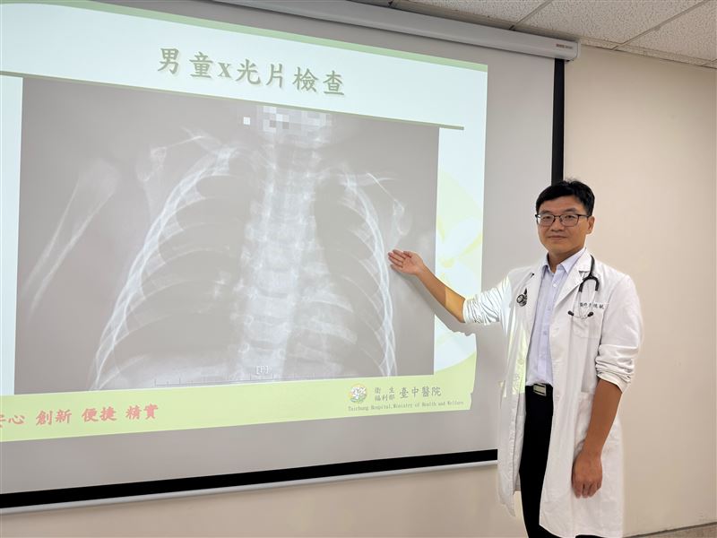 男童感染致死率高達三成以上的血清型肺炎鏈球菌，到院時X光片卻仍清澈，未因感染白成一片。(圖／臺中醫院提供)