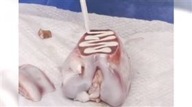 中國浙江大學醫學院附屬邵逸夫醫院近日宣布，自主研發出一款「骨膠水」，能在3至5分鐘內將斷裂或粉碎的骨頭黏合。（圖／翻攝自微博／頭條新聞）