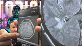 館長自爆「腦有問題」！X光片曝光：少了一部分（圖／翻攝自YT＠館長惡名昭彰）