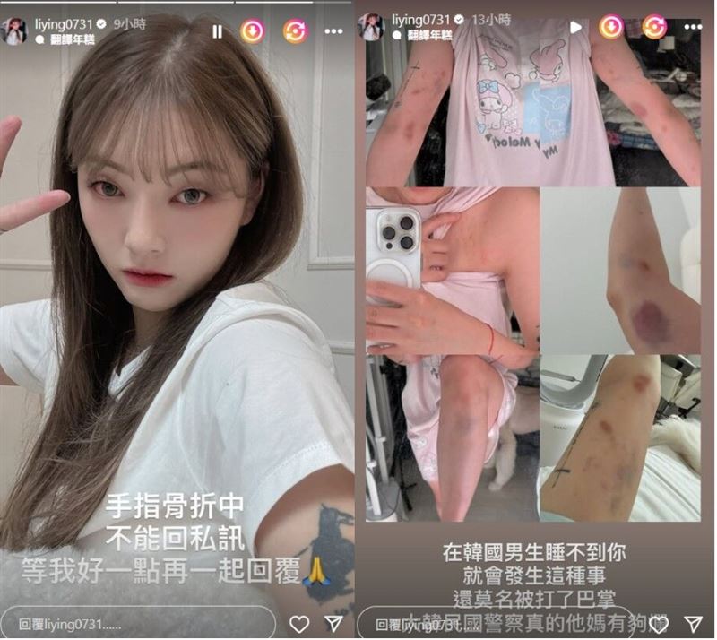 劉力穎公布被打照片。（圖／翻攝自IG）