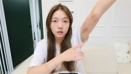 台女YTR拒陪睡韓男遭暴打　示警別1人去這