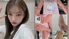 劉力穎公布被打照片。（圖／翻攝自IG）