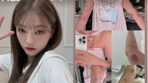 台正妹YTR韓國遭暴打　路人拒報警原因曝