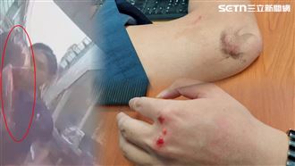 趕考Uber「遭毀容」大翻車：襲3警撕血皮