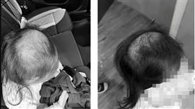 基隆一名媽媽昨天（16日）在臉書發文指出，6歲女兒去年就讀七堵區某幼兒園大班時，多次出現莫名哭泣、夜間驚醒、拒絕上學等異常行為，去年8月某日上學時，女兒甚至情緒失控把自己的頭髮都拔光幾乎禿了，懷疑幼兒園老師對女兒有施暴情事，除了向基隆市府申訴外，另對涉案老師提告。