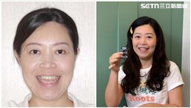 黃小姐經過上牙醫求診後，終於成功用門牙咬斷吐司。（圖／翻攝畫面）