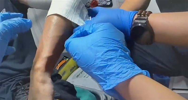 員工身上有二度燒燙傷。（圖／翻攝畫面）