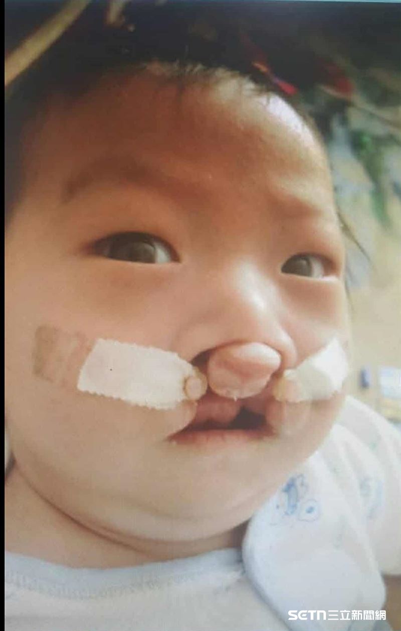 Tom是家中第三個孩子,媽媽說,出生時才發現他是雙側唇腭裂寶寶,當下真的非常難過和震驚,因為產檢時醫師都沒有告知有這情況,加上家裡也沒有任何家人有這樣的情形,所以那時的心情非常的不安和害怕。(圖/受訪者提供)