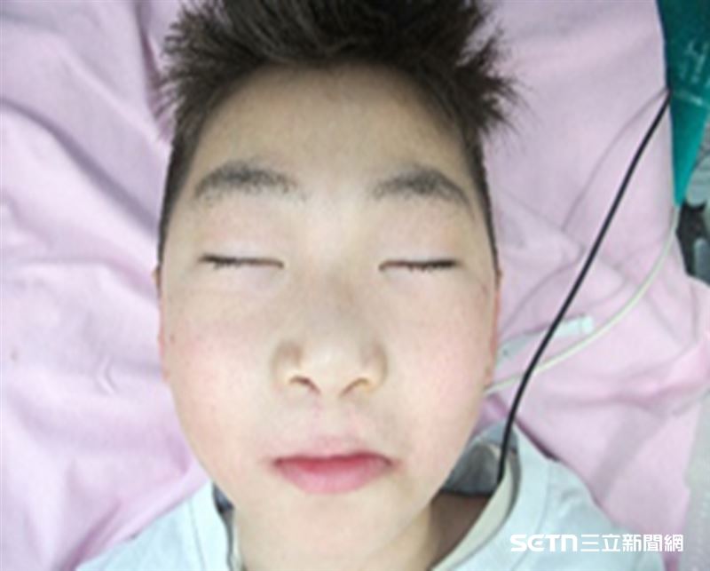 Tom前前後後經歷了5次手術,其中兩次,分別在5歲和9歲時,都是由羅慧夫顱顏基金會攜手長庚醫院顱顏中心團隊共同組成的「用愛彌補義診團」的羅綸洲醫師主刀。媽媽說,台灣的醫療手法和帶來的器具等明顯就很不一樣,非常感謝和榮幸可以被台灣醫師治療和手術。(圖/羅慧夫基金會提供)