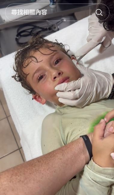 男童到海邊玩，回家後感覺耳朵怪怪的，立刻到醫院就醫。(圖／翻攝自TikTok＠kitziamitre)