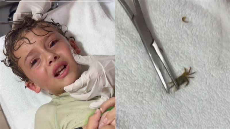 男童哭鬧「耳朵怪怪的」！醫竟夾出活螃蟹