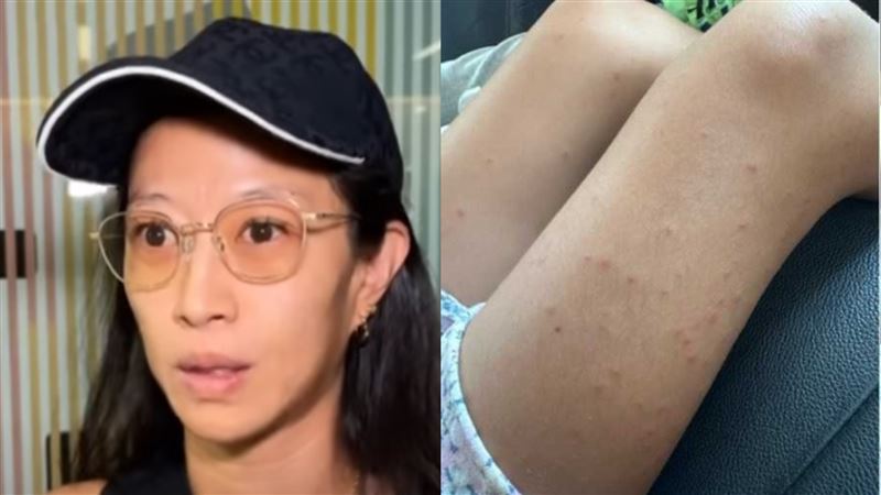 日本媽住日月潭五星酒店！遭床蝨咬沒賠償