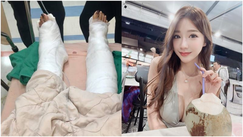 翻船害「最美禮生」嫩白腿留疤!賠償金曝