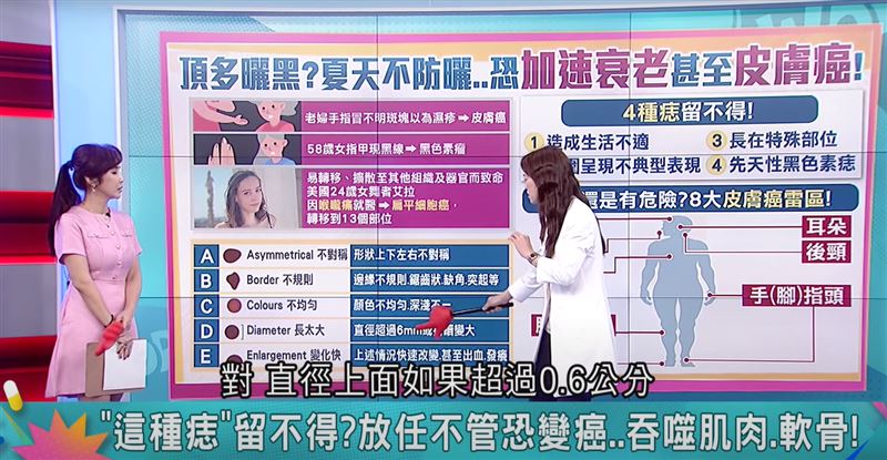 皮膚突長黑痣要警覺！一名30多歲軍人發現，小腿上的黑痣持續變大，就醫確診黑色素細胞癌。（圖翻攝自／祝你健康）