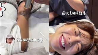 一隻阿圓雷射除刺青　痛到臉部扭曲全被拍