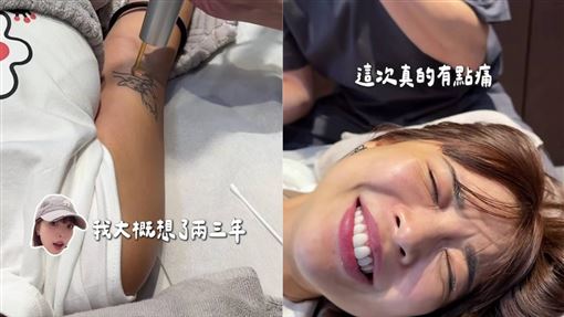 一隻阿圓雷射除刺青　痛到臉部扭曲全被拍