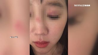 台灣妹子英國遇襲　遭陌生人甩牆、圍毆