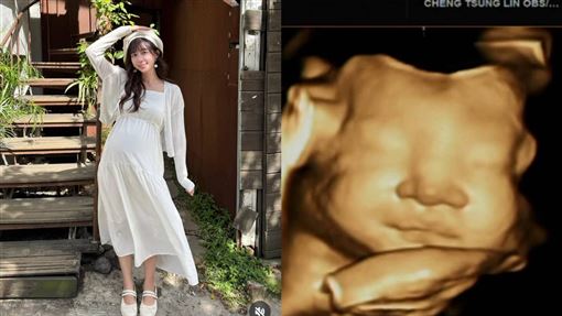 洪詩曬二寶超音波　拍到正臉清晰輪廓樂歪