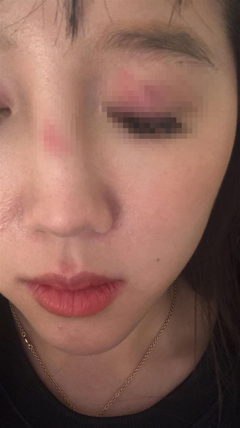 原PO肩膀被路過的白人女生撞上，甚至還遭到圍毆。（圖／網友vanessa._.42授權提供）