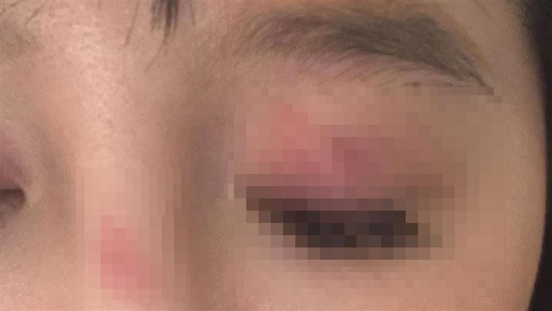 台灣妹在英國遭4女圍毆!遭扯頭髮甩牆上