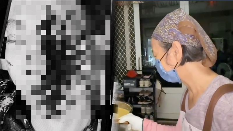 阿嬤除了祈願主治醫師可以保住孫子另一顆眼睛，同時投靠信仰，「創價佛學會會員已舉辦集體『唱題』集氣、念南無妙法蓮華經」，盼能換得孫子一線生機。（圖／翻攝畫面）