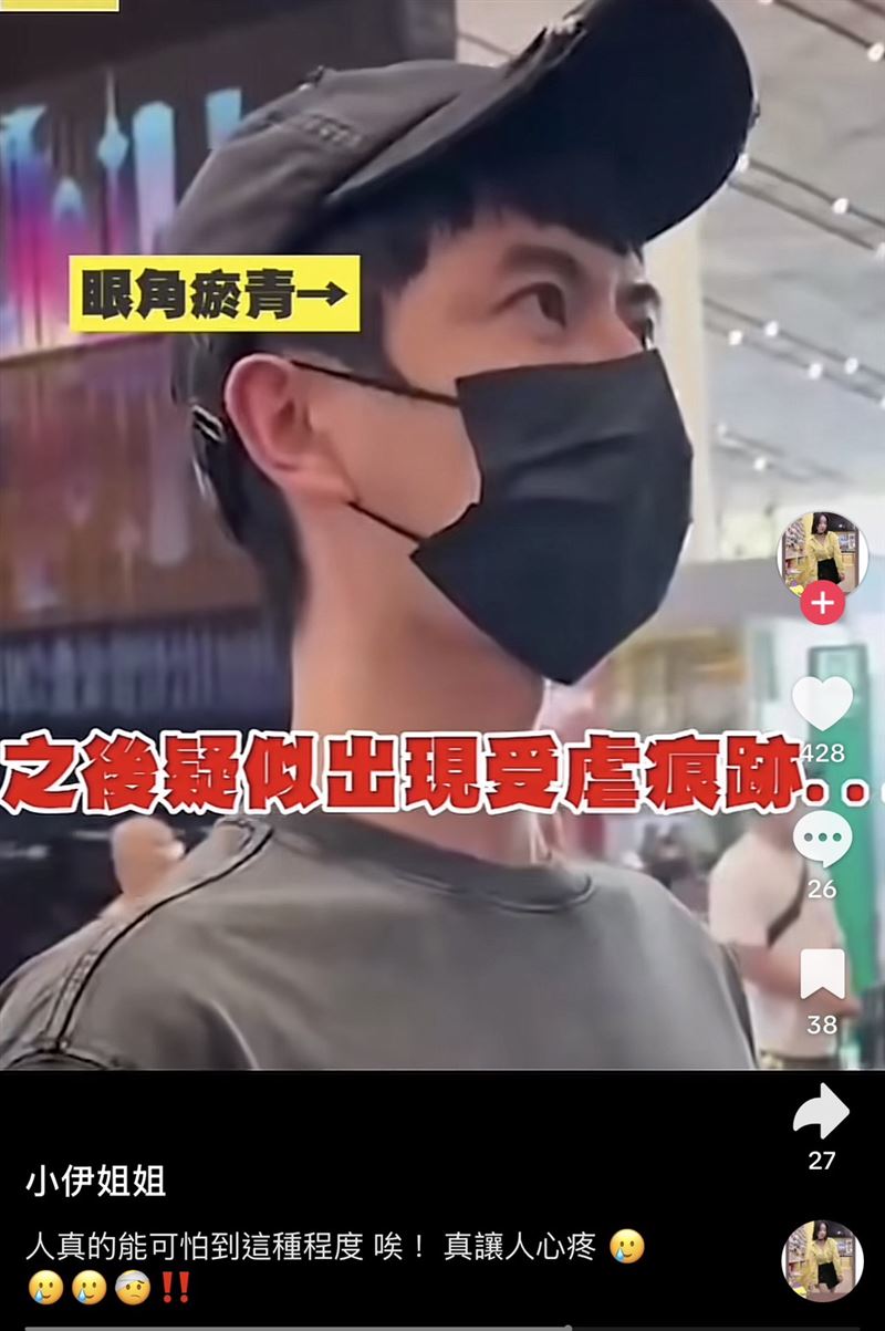 于朦朧過去曾被拍到眼角、嘴角疑似有瘀傷。（圖／翻攝自小伊姐姐 TikTok）