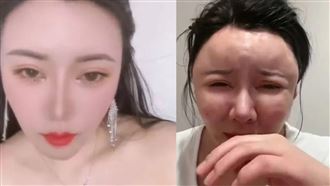 正妹打生長因子想變美！臉饅化慘成面具人